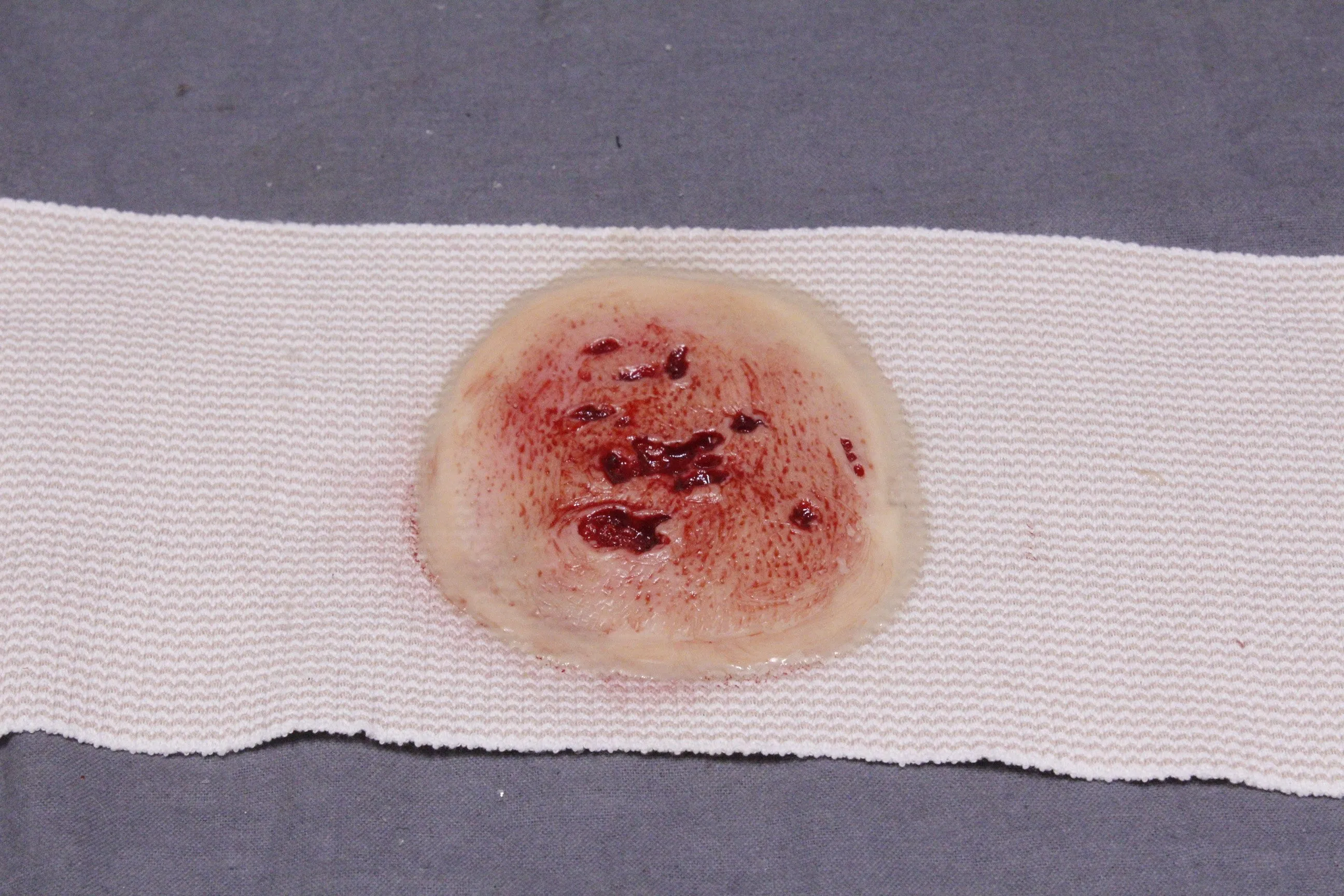 Dura Strap-On Wound Kit