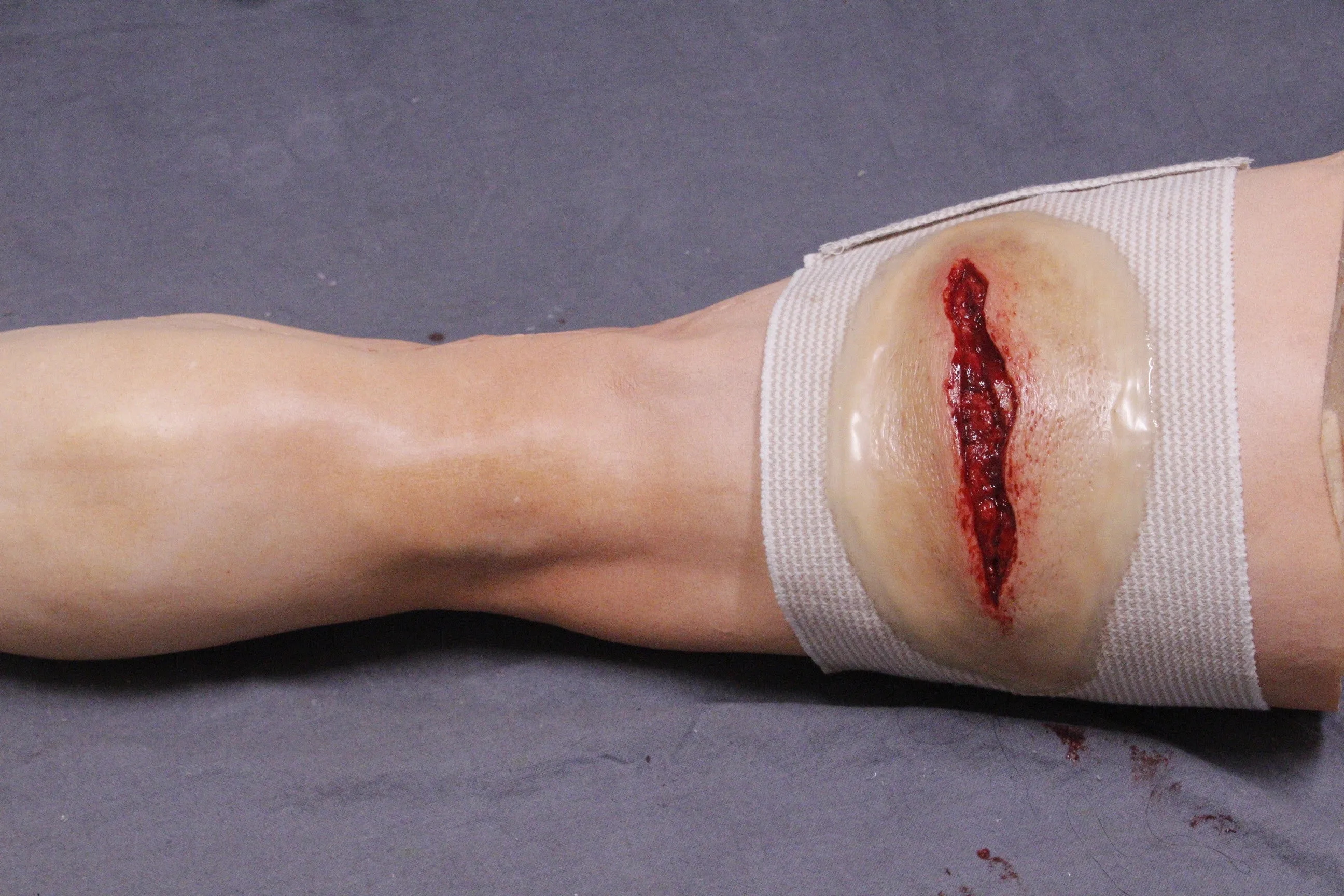 Dura Strap-On Wound Kit