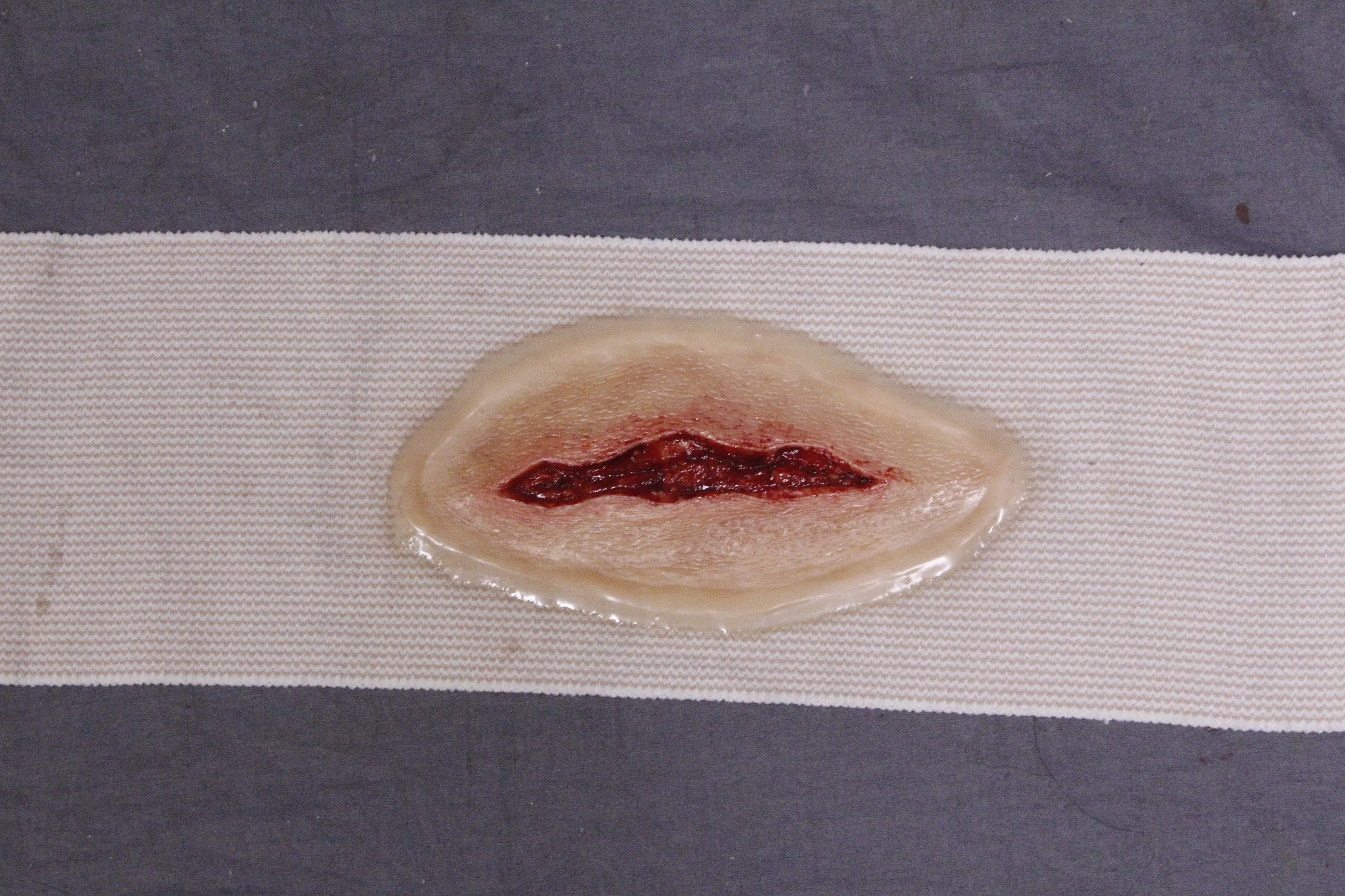 Dura Strap-On Wound Kit