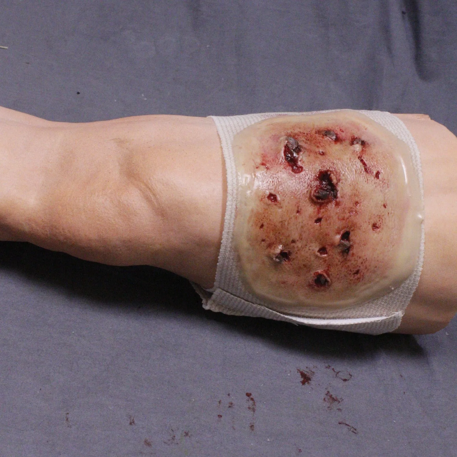 Dura Strap-On Wound Kit